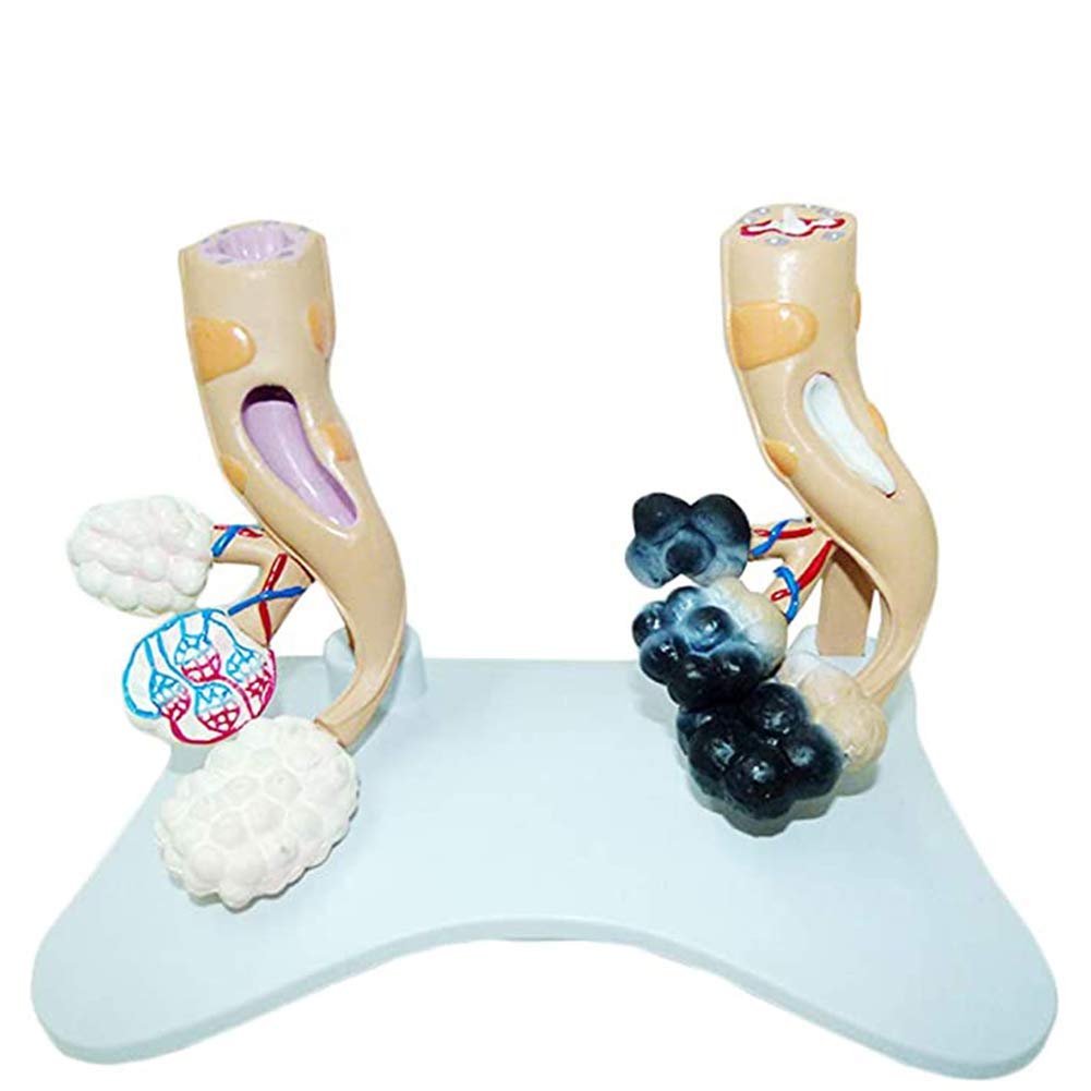 Sjdopulse Human Smoking Lung Health Alveolar Model, Alveolar Model, Comparison Of The Two Models