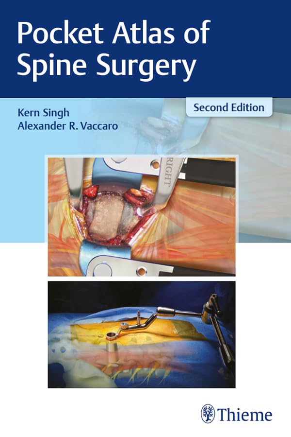 Pocket Atlas of Spine Surgery (English Edition)
