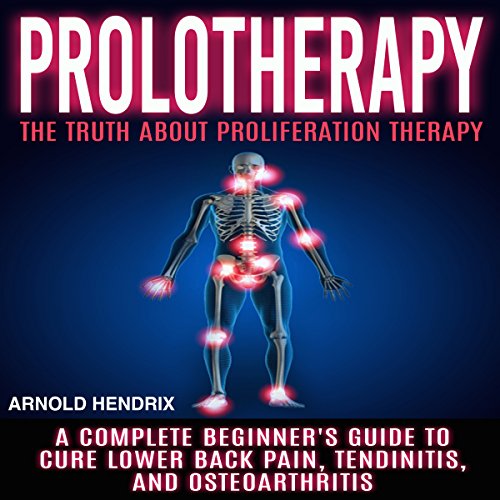 Prolotherapy The Truth About Proliferation Therapy A Complete