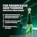 Rene Furterer Triphasic Progressive Concentrated Serum for Hereditary, Hormonal Thinning Hair - Drug-Free - Receding Hairline - Leave-In - Sulfate, Paraben, Silicone-Free - 8 ct., 30-Day Supply