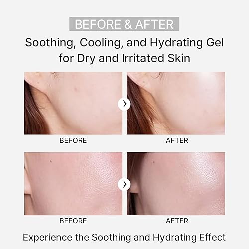 Miniatura 8 de ARZTIN Rejuvenation Pflege Gel, gel suavizante facial y corporal, gel no pegajoso, After Sun con aloe, agua mineral, 4.4 onzas líquidas