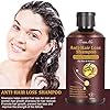 Hair-Growth-Shampoo-Hair-Loss-Shampoo-Hair-Thickening-Shampoo-Helps-Stop-Hair-Loss-Grow-Hair-Fast-Hair-Loss-Treatment-for-Men-Women-220mL Hair Growth Shampoo, Hair Loss Shampoo, Hair Thickening Shampoo, Anti-Thinning Shampoo, Hair Growth-Thickening Shampoo, Hair Loss Treatment, for Stop Hair Loss, Grow Hair Fast, Men & Women, 220ML