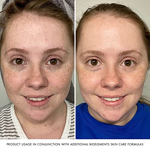 Bioelements Equalizer - 6 Fl Oz - Hydrating Facial Toner For All Skin Types - Vegan, Gluten Free - Never Tested On Animals #TOP3