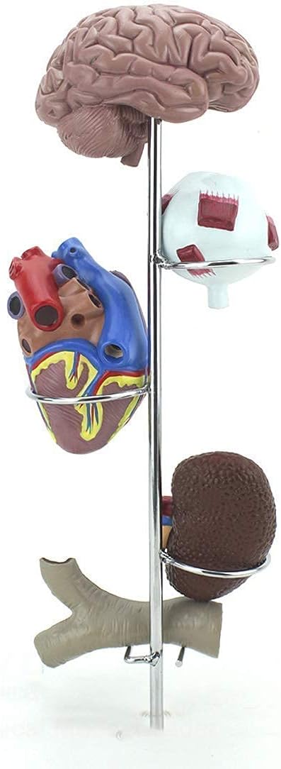 Modelo anatómico Hipertensión Conjunto de Modelos de órganos anatómicos Cerebro Ojo Corazón Arteria renal, Modelos médicos