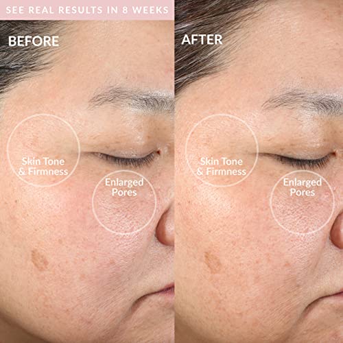 Pmd Clean - Smart Facial Cleansing Device With Silicone Brush & Anti-Aging Massager - Waterproof - Sonicglow Vibration Technology - Clear Pores And Blackheads - Lift, Firm, And Tone Skin #TOP3