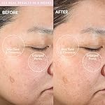 PMD Clean - Smart Facial Cleansing Device with Silicone Brush & Anti-Aging Massager - Image 4