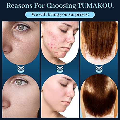 Tumakou F10 High Frequency Facial Wand thumb #4