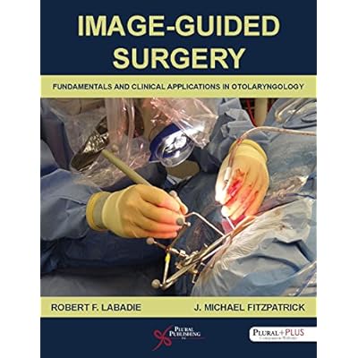 Image-Guided Surgery