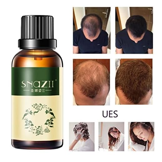 Toamen Crecimiento Del Cabello Esencia De Adelgazamiento Avanzado Del Cabello Y Suplemento De PéRdida De Cabello (A)