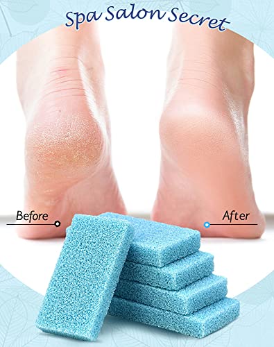 Image of Maryton Disposable Foot Scrubber Pedicure Pumice Stone for Feet, 40PCS