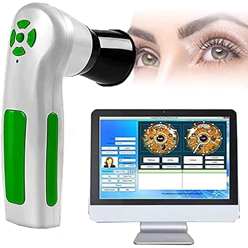 Auto Focus Iris Machinem,12 Million Pixel Iris Detector,Usb2.0 Interface Iriscope Diagnostic Eye Camera,Diagnostic Eye Camera,Health Clubs, Personal Health Management Centers