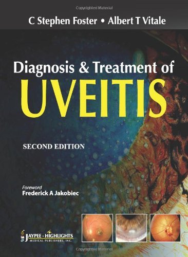 Diagnosis and Treatment of Uveitis by Foster, C. Stephen, Vitale, Albert T. (2013) Hardcover: C. Stephen Foster: Amazon.com
