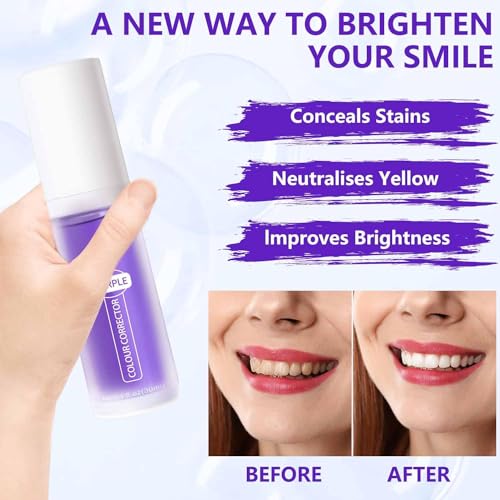 Higiene Bucal Y Dental, Drugstore tiras blanqueadoras Marca LONEOURS (2)