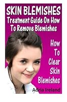 Skin Blemishes : Treatment Guide On How To Remove Blemishes: How To Clear Skin Blemishes 1481127861 Book Cover