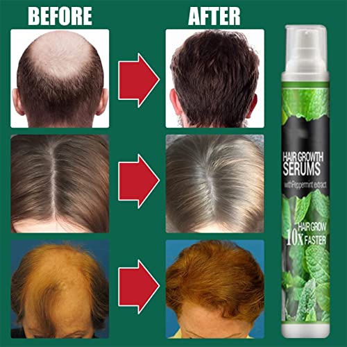 PICKX Herbal Hair Growth Essence Spray Herbal Hair...