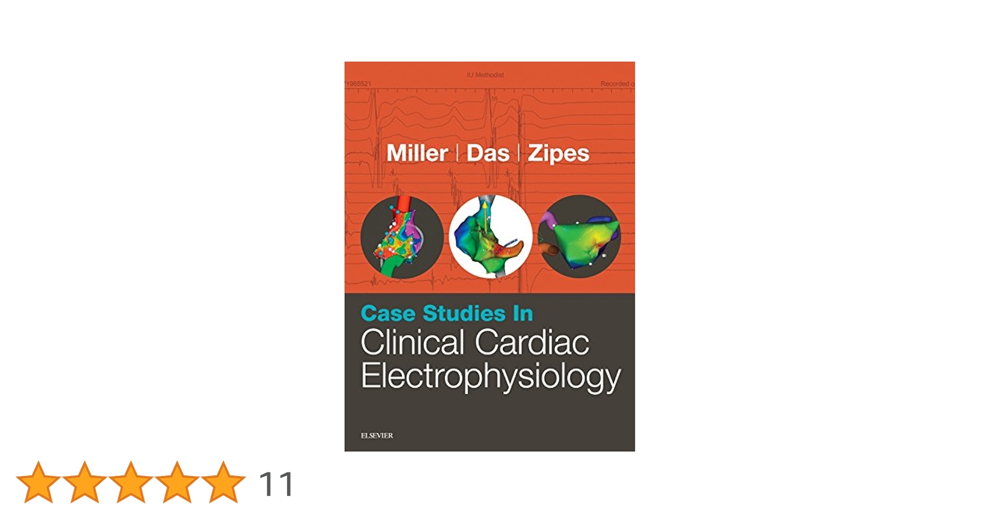 Case Studies in Clinical Cardiac Electrophysiology [ハードカバー] Miller MD，John M.、 Das MD，Mithilesh K.; Zipes MD，Douglas P. Amazon.com: Case Studies in Clinical Cardiac