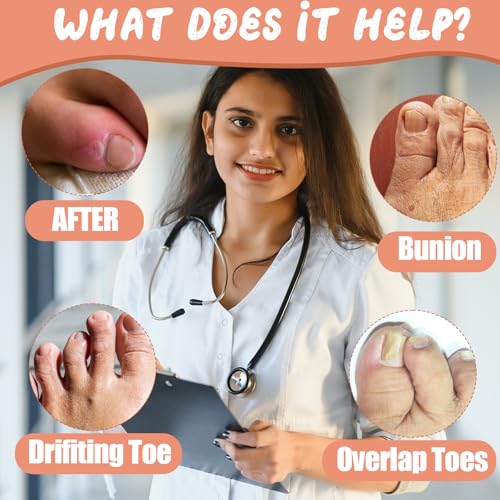 Image of 8 Pcs Pinky Toe Separator Bunion Corrector Toe Spacers Little Toe Protectors Pain Relief Cushions Soft Bunion Pads for Men Women Overlapping Toe Curled Pinky Toes Preventing Rubbing Relieve Pressure