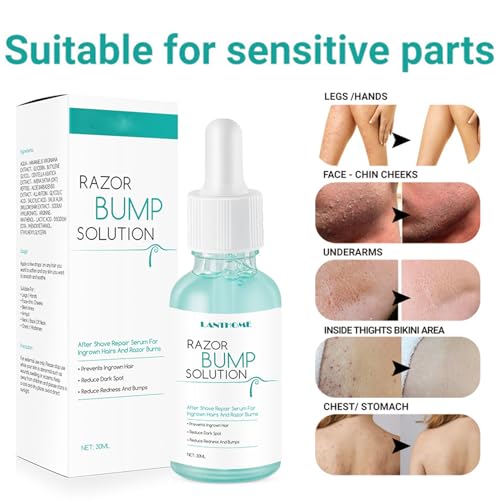 Ingrown Hair Reduction Serum,Ingrown Hair Serum For Man and Women,Gentle to Redness And Razor Bump Stopper Solution Dark Spot Corrector After Shave Repair Serum For Ingrown Hair,30ml - Image 4