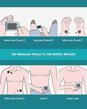 PULSE 心拍数モニタリングデバイス PULSE 心拍数モニタリングデバイス hospital-monitor-displaying-