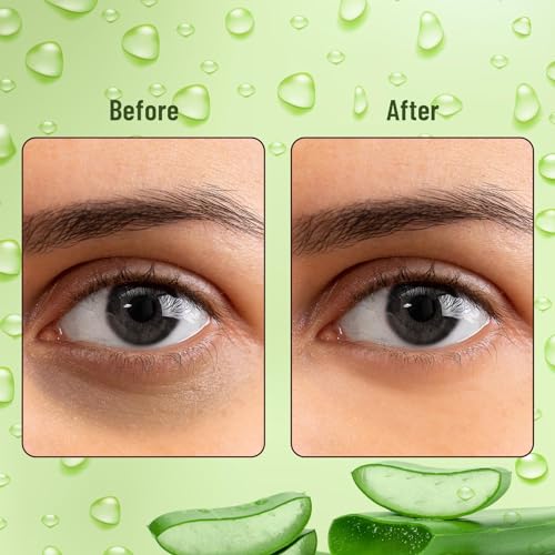 Image of Hydra Eye Serum Patch| Treats Dark Circles, Fine Lines And Wrinkles | Enriched With Collagen And Aloe Vera Extract | Shade -Gold, 60 Pcs| (Aloe Vera)