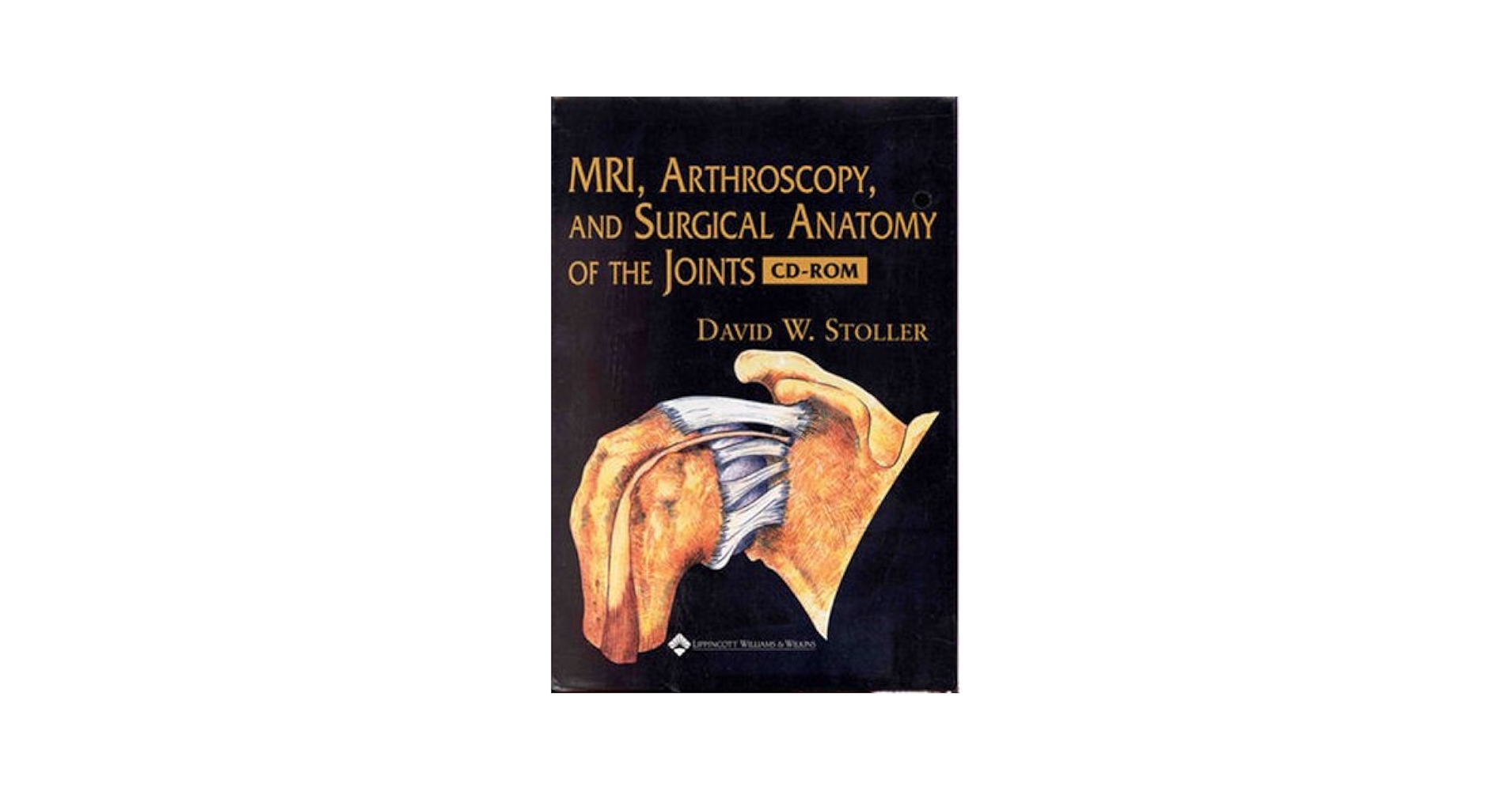 MRI, Arthroscopy, and Surgical Anatomy of the Joints