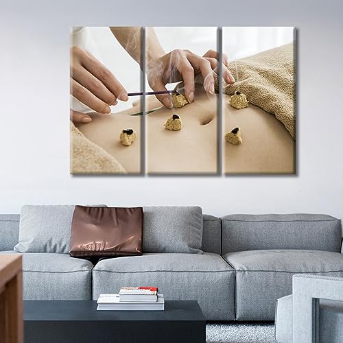 Image of Posters & Prints 3 Panels Nosocomium Paintings Wall Art Moxibustion Art Prints Framed Wall Art Nosocomium Giclee Wooden Framed Gallery-Wrapped Ready to Hang (42 inch Wx28 H)