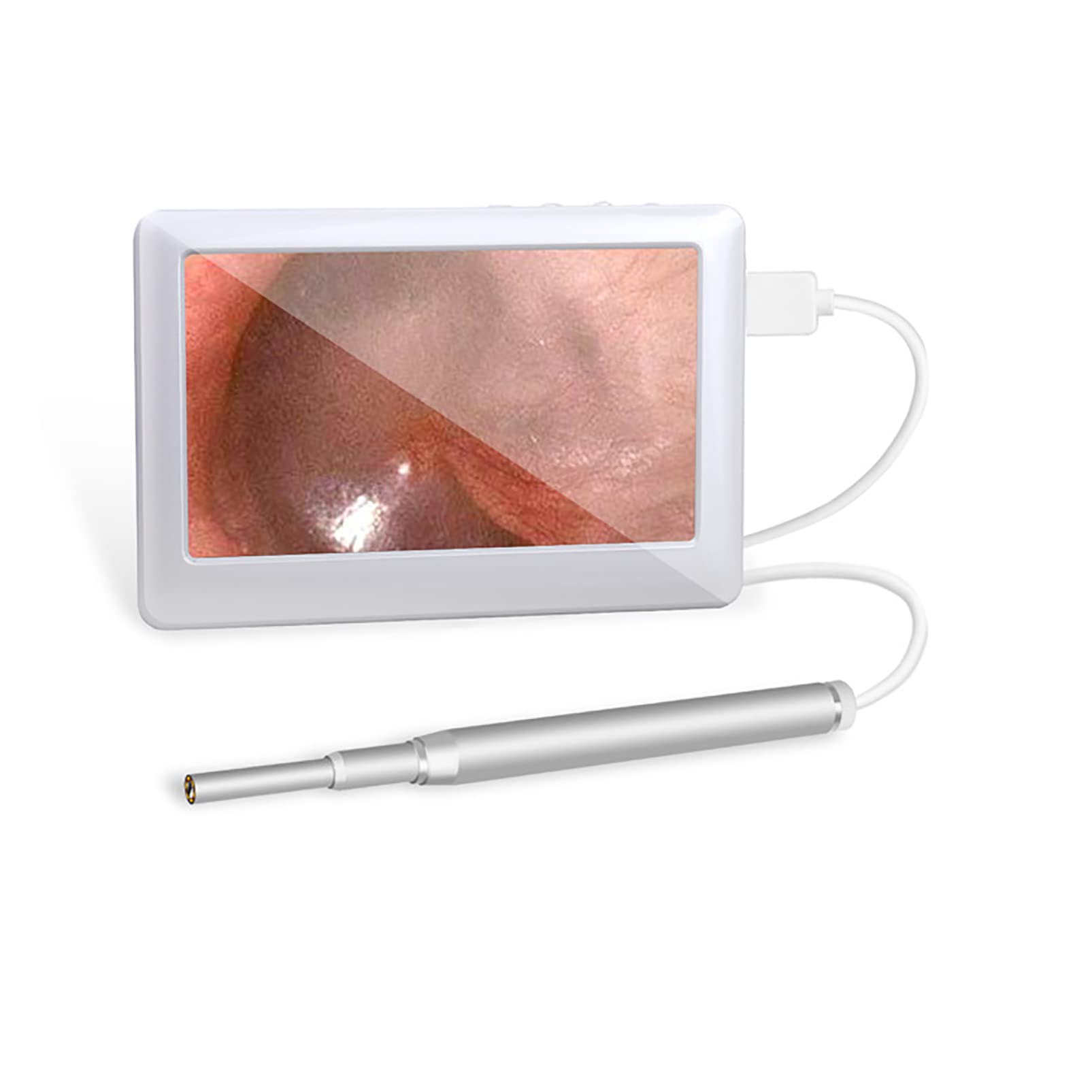 Otoscopio de Eliminación de Cerumen, Cámara Limpiadora de Oídos Profesional con Lente de 3,9 Mm con Selección de Oídos, Otoscopio Limpiador de Oídos con 6 Luces LED, Dispositivos para Mamá