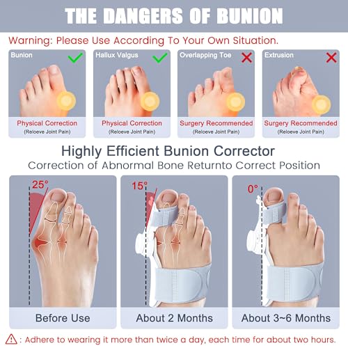 JOLAYSO Bunion Corrector, Adjustable Knob Bunion Brace Splint for Big Toe Relief, Hammer Toe Straightener, with Toe Separator, Suitable for Left and Right Feet - Image 3
