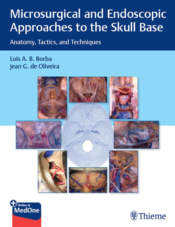 Microsurgical and Endoscopic Approaches to the Skull Base: Anatomy, Tactics, and Techniques (English Edition)