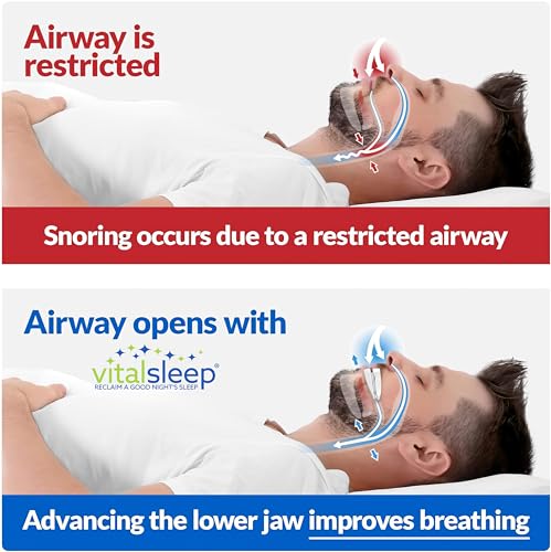 VitalSleep Anti-Snoring Mouthpieces – Set of 2 Men’s Snore Guards – Personalized, Adjustable Snoring Solution for Better Sleep – Made in The USA