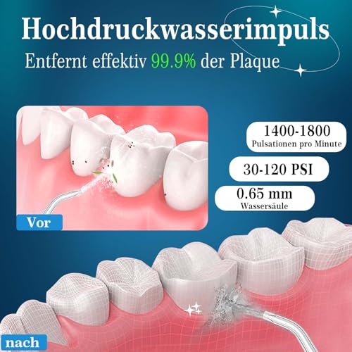 SURFOU Munddusche Kabellos, Elektrische Zahnseide Oral Irrigator Zahndusche Wasser Zahnreiniger, Zahnzwischenraumreiniger Elektrisch Wasserflosser für Zähne Water Flosser for Teeth – Bild 3