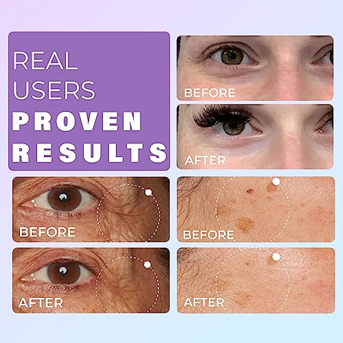 Gopure Actives Serum Trio Set - Radiant Vitamin C Serum, Hydrating Hyaluronic Acid Serum, Retinol And Bakuchiol Serum For Visibly Bright, Smooth, And Firm Looking Skin - Set Of 3, 1.0 Fl Oz #TOP5