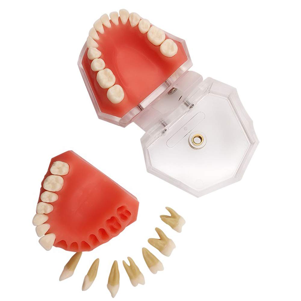 Sjdopulse A Dental Implant Teeth Model - Teeth Teaching Model - Removable Dental Care Model - Dult Standard Dental Teeth Tooth Model - For Study Teaching Demonstration (A)