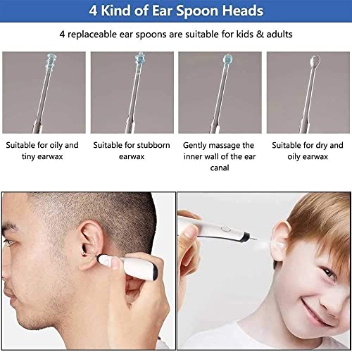 Mxjcc Ear Wax Removal - Earwax Remover Tool - Ear Cleaner With Camera - Earwax Removal Kit With Light - Ear Cleaner For Kids, Adults & Pets (Color : White) #TOP1