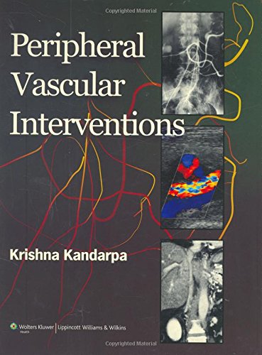 Peripheral Vascular Interventions