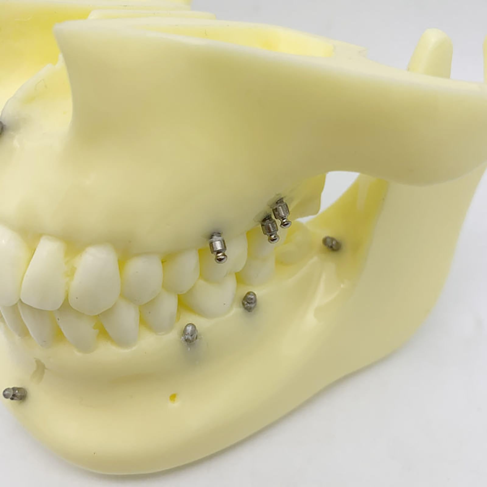 Modello dentale di base per la formazione sull'implantologia, a scopo didattico per studi odontoiatrici e ricerca medica.
