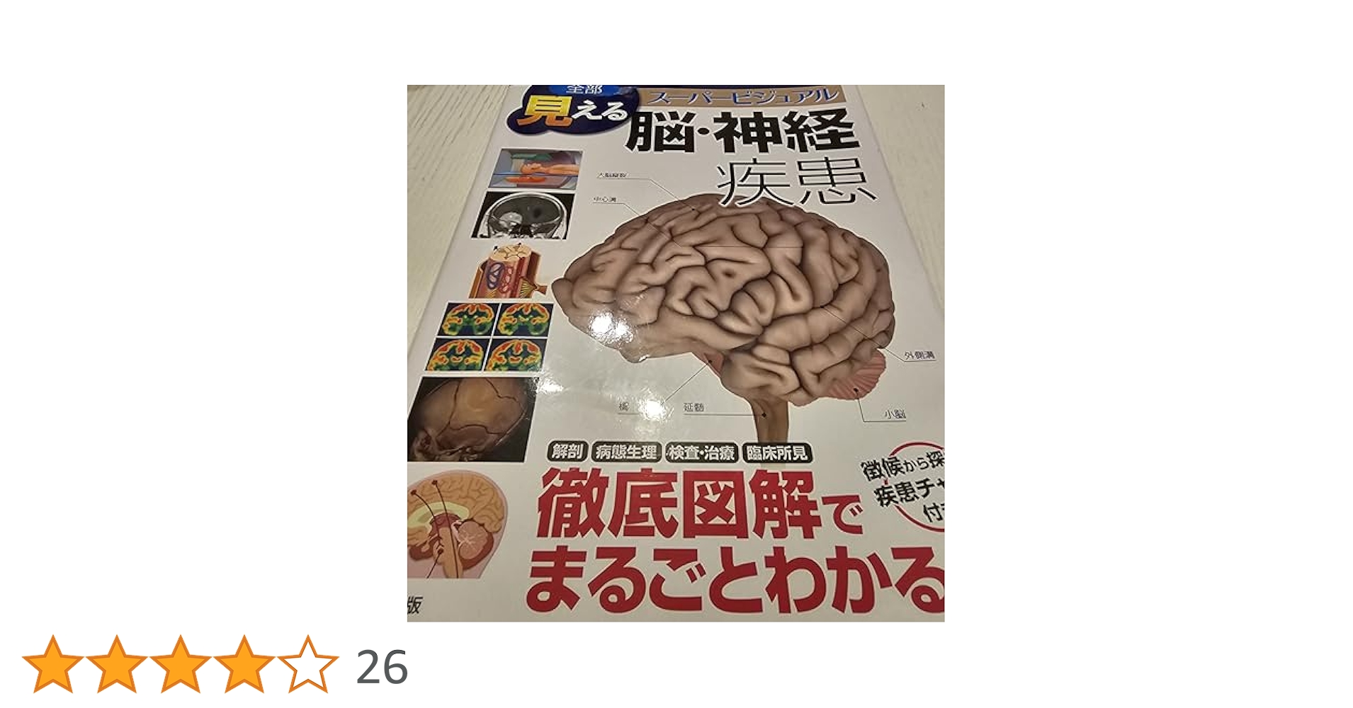 南江堂　脳・神経疾患 Amazon.co.jp: 全部見える脳・神経疾患: ス-パ-ビジュアル