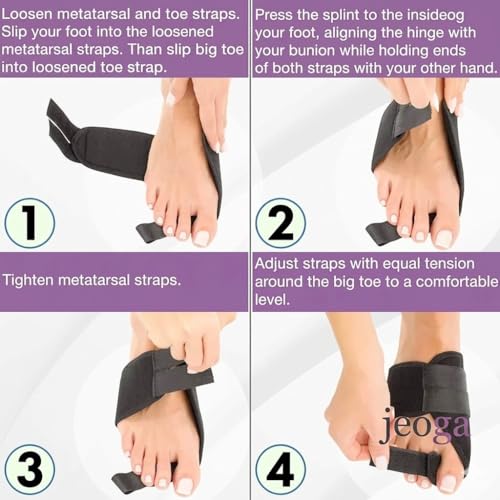 Image of Pack of 2 Orthopedic Toe Separators for Bunion Correction & Toe Alignment | Adjustable Bunion Corrector Splint for Hallux Valgus Pain Relief | Comfortable Toe Straightener Support for Men & Women (Black) (BLACK)