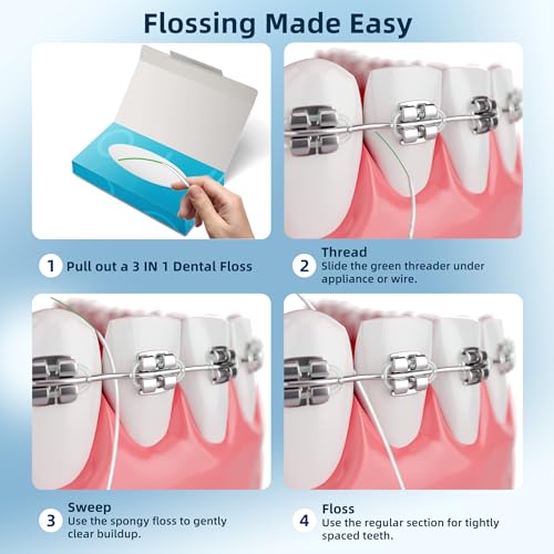 Image of VINSULLA 3-in-1 Orthodontic Dental Floss for Braces & Implants | Built-in Threader, Spongy & Regular Floss, PFAS & PTFE-Free, Unflavored, 160 Pre-Cut (2 Pack)