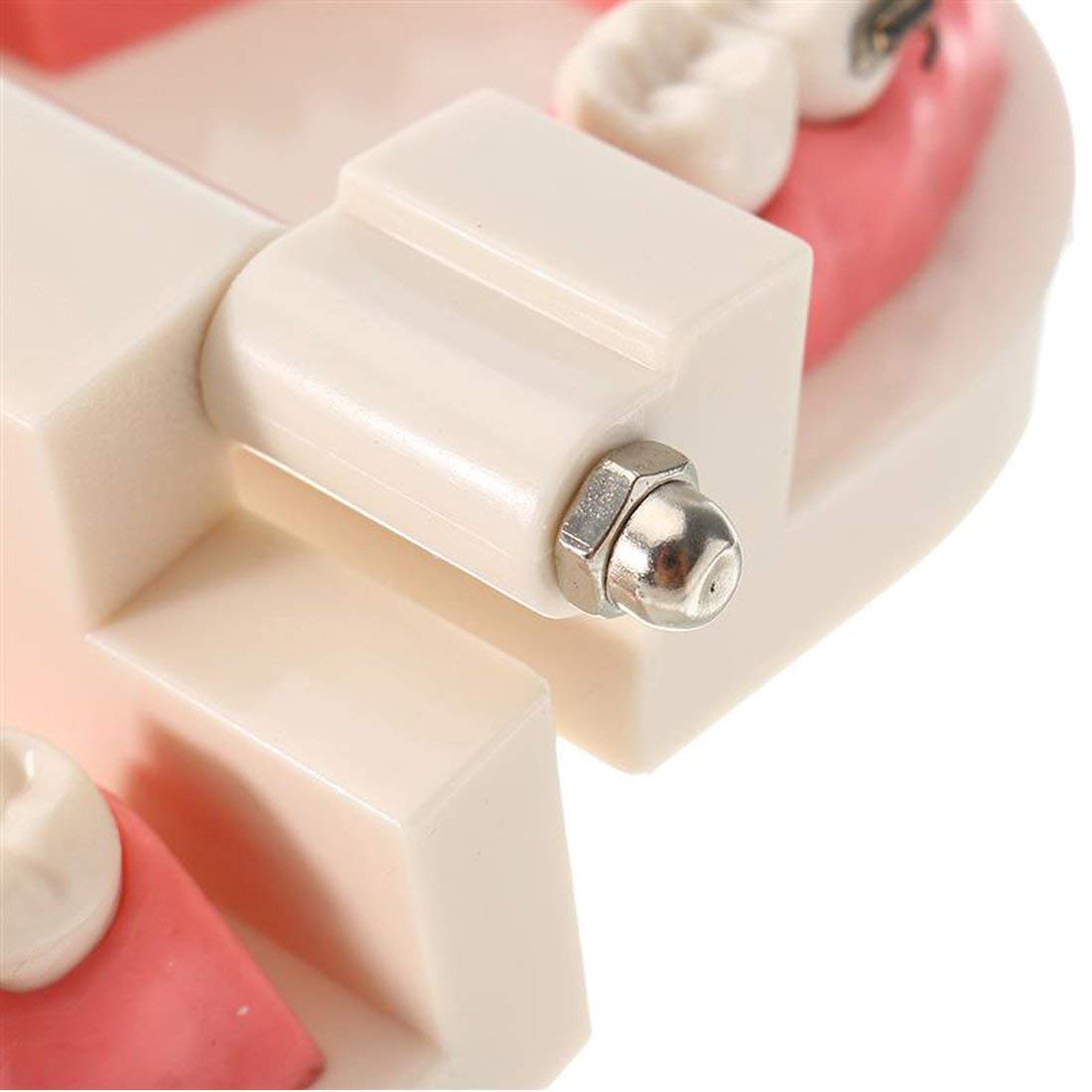 ERNZI Kieferorthopädische Zahnärztliche Behandlungsmodell Mit Keramischer Brackets, Kieferorthopädischer Metalldraht, Orale Kanalligatur, Verwendet Für Zahnärztliche Werkzeuge, Zahnärztliches Labor