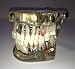 Yosoo Dental Study Teaching Teeth Model Adult Typodont Model Removable Tooth
