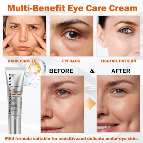 Temporary Eye Tightener Cream - Instant Eye Bag Tightening Cream with Brush, Wrinkle-Reducing for Under Bags & Fine Lines, Quick Face Firming Smoothing, 20ml - Image 3