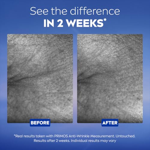 NIVEA Cellular Epigenetics Age Rewind Gesichtsserum mit Epicellin, 30 ml – Ansicht 5