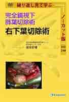完全鏡視下肺葉切除術 右下葉切除術 ノーカット版 [DVD] | 宮本