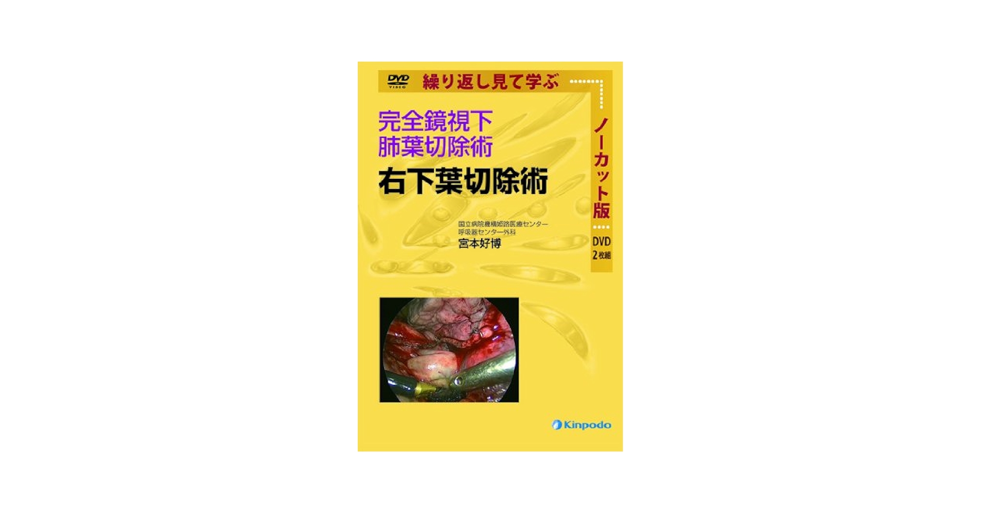 完全鏡視下肺葉切除術 左上葉切除術 [DVD] m3電子書籍 | DVD 完全鏡視下肺葉切除術 右上葉切除術