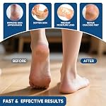 Urea Cream 40% Plus Salicylic Acid 2%, Urea Cream 40 Percent for Feet Maximum Strength, Foot Cream for Dry Heels Cracked - Image 4