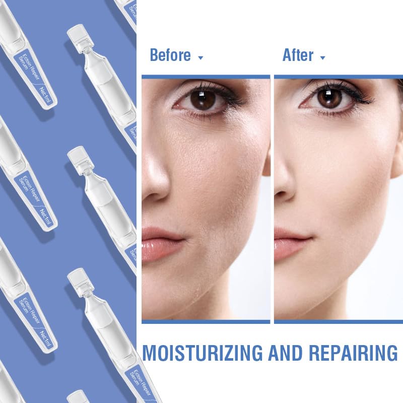 Ection Hydrating Repair Facial Serum Ampoule, Deep Moisture & Anti-Aging Serum with Beta-Glucan Glycerin Hyaluronic Acid For All Skin Redness Relief & Barrier Repair, 15PCS Single Use Ampoules - Image 3
