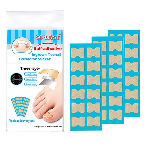 shamjina Ingrown Toe Nail Correction Toenail Straightener Corrector Toe Nail Orthosis - 36 Sheets