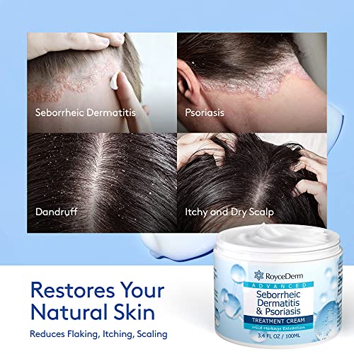 Roycederm Seborrheic Dermatitis Cream, Psoriasis Cream, Scalp Treatment For Psoriasis, Folliculitis Treatment, Dry Scalp, Dandruff, Seborrheic Dermatitis Treatment, Anti-Itch Cream, Soothing Relief #TOP2