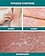 N1 Psoriasis Intensivcreme 50 ml - Ekzem & Neurodermitis Creme - beruhigt, pflegt, lindert und glättet rote, schuppige, entzündete & trockene Haut